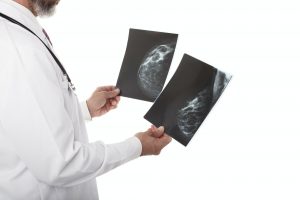 Doctor with breast Xray